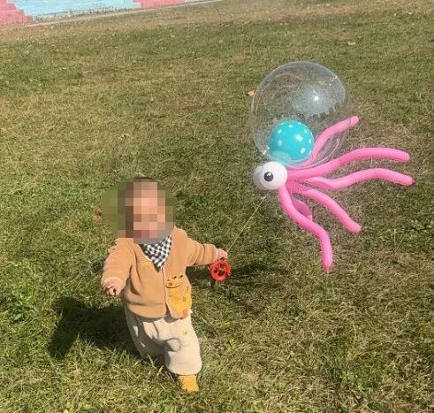 孩子手、脸都被烧伤！这种玩具千万别买