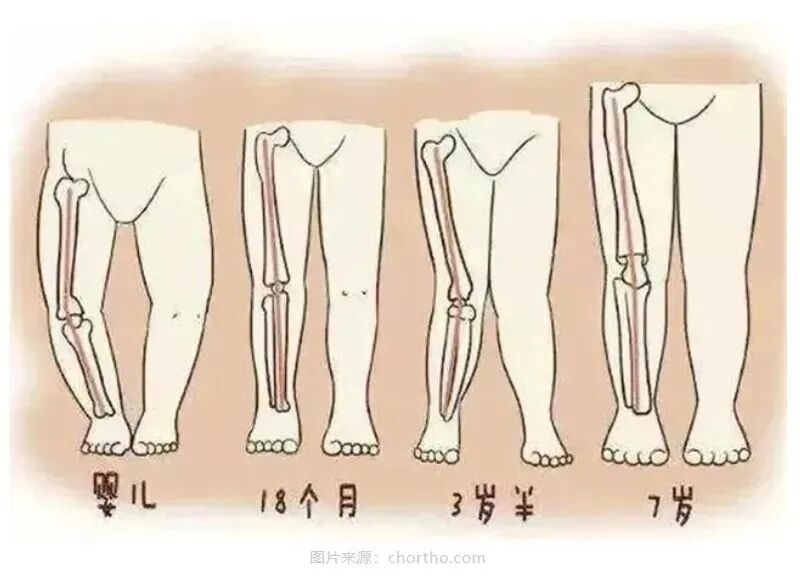 别穿！别穿！最近极受欢迎，医生建议：不建议超过3.5厘米，网友：天塌了……