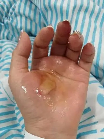 电热水器这个地方滴水正常吗？今晚洗澡前紧急提醒！