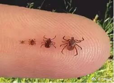 农妇突然病危 原来病因藏在肩上焦痂 农妇突然病危 原来病因藏在肩上焦痂