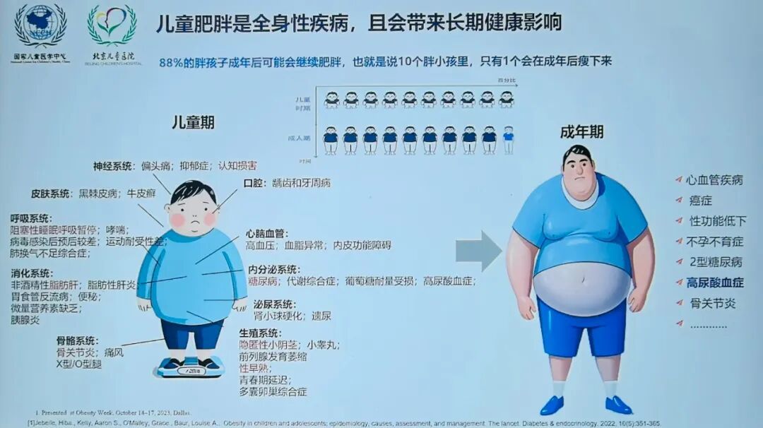 每5个孩子就有1个超重！医生教你三招，从饮食到运动全搞定