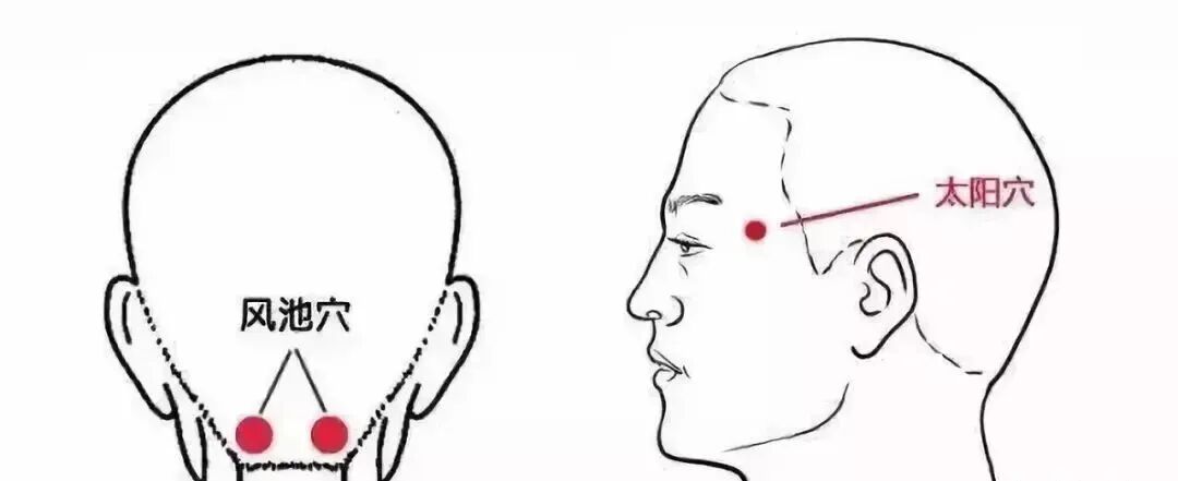 这种头疼会“致残”！千万别以为是小毛病