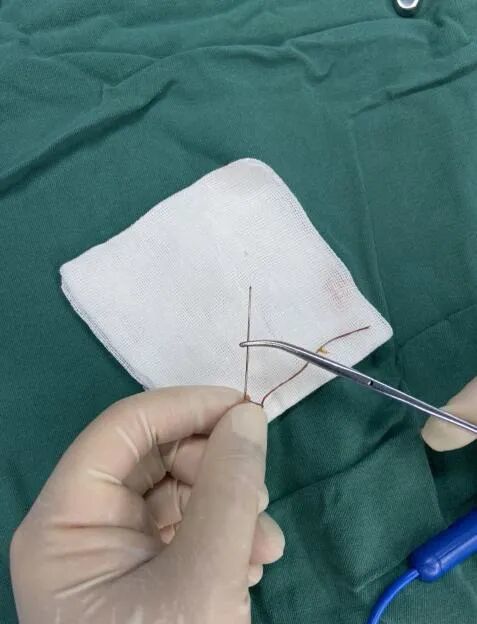 惊险！约3厘米长缝衣针裹被子里，扎入9月龄宝宝脊柱 ，医生：针的位置极其刁钻