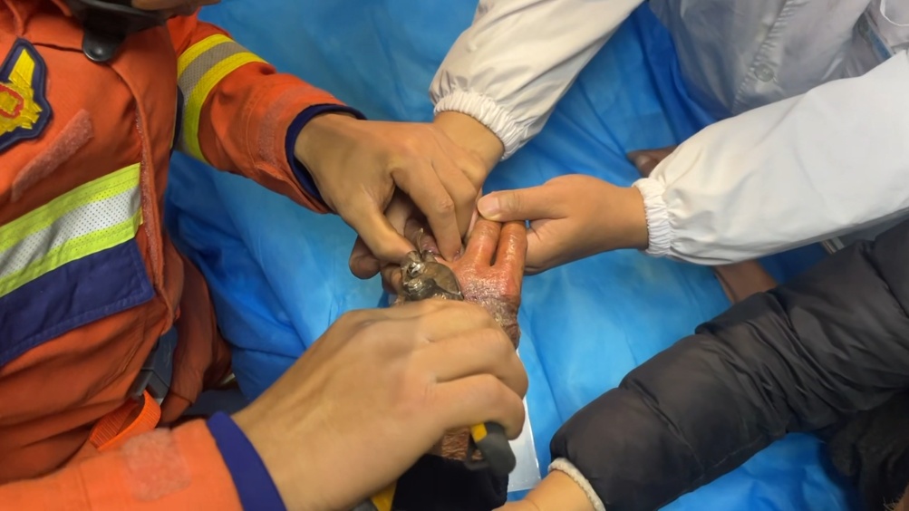 老人中毒被急送医院,手上的它却成救治“拦路虎” 老人中毒被急送医院,手上的它却成救治“拦路虎”