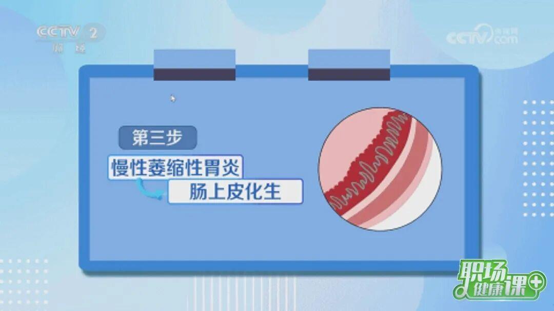 感染“幽门螺杆菌”到“胃癌”只有5步 预防这样做→