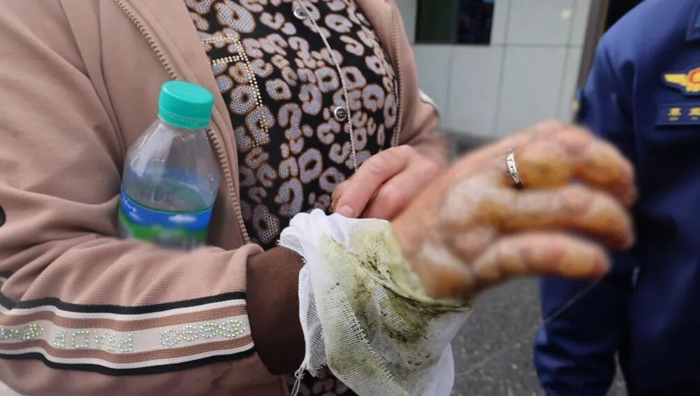 老人中毒被急送医院,手上的它却成救治“拦路虎” 老人中毒被急送医院,手上的它却成救治“拦路虎”