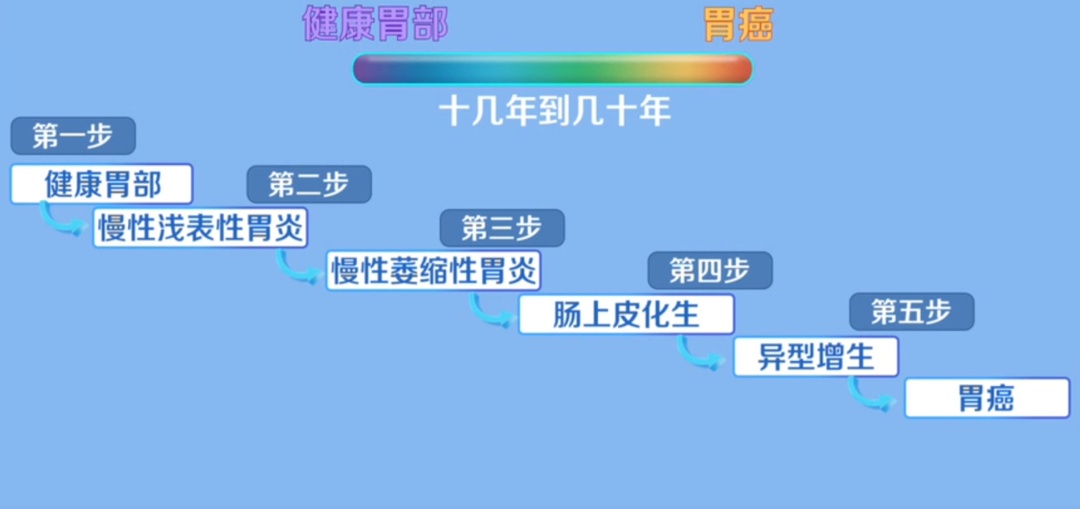 感染“幽门螺杆菌”到“胃癌”只有5步 预防这样做→