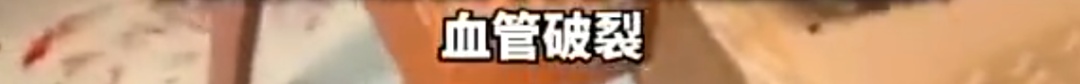男子街头冻到血管破裂？民警提醒……