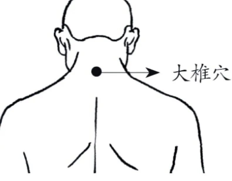 生病自己治？当心吃错药！发烧咳嗽用药的常见误区