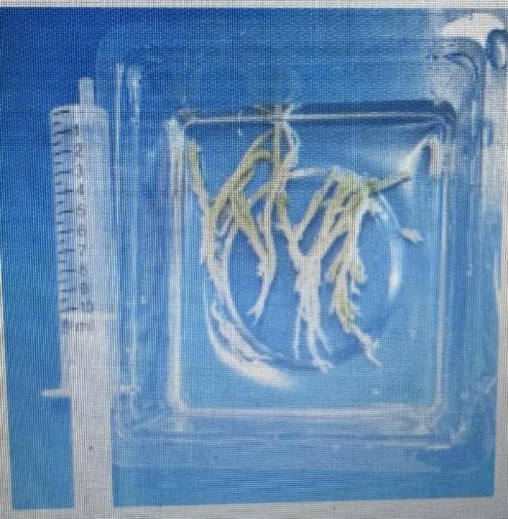 早上发烧,晚上就“白肺”!连续两年因流感进ICU!肺里长出这种“死亡树杈” 早上发烧,晚上就“白肺”!连续两年因流感进ICU!肺里长出这种“死亡树杈”