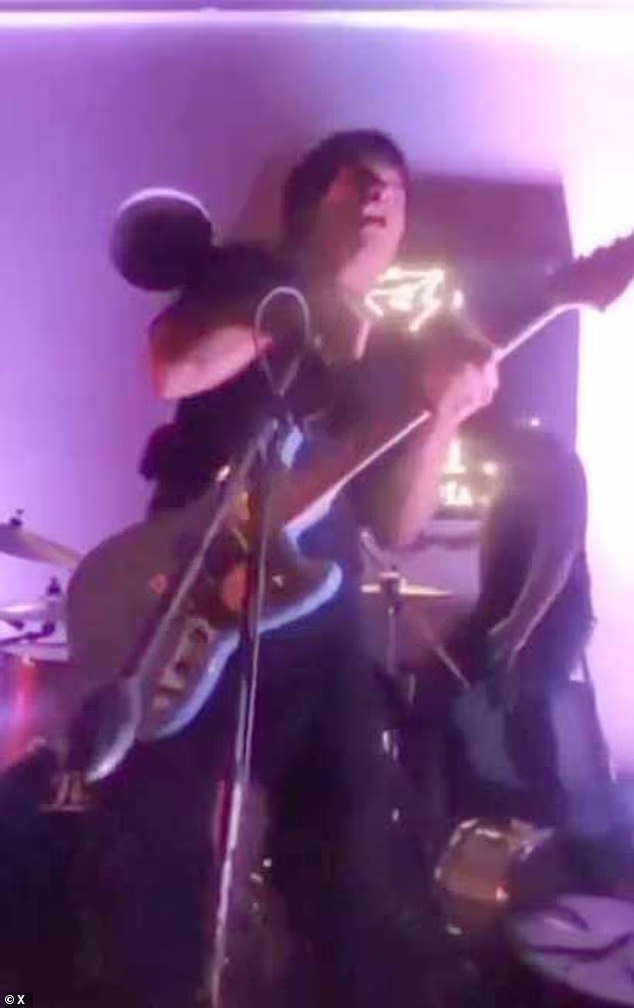 秘鲁21岁歌手被麦克风电击倒地,现场火花四溅,此次电击造成他颈部烧伤 秘鲁21岁歌手被麦克风电击倒地,现场火花四溅,此次电击造成他颈部烧伤