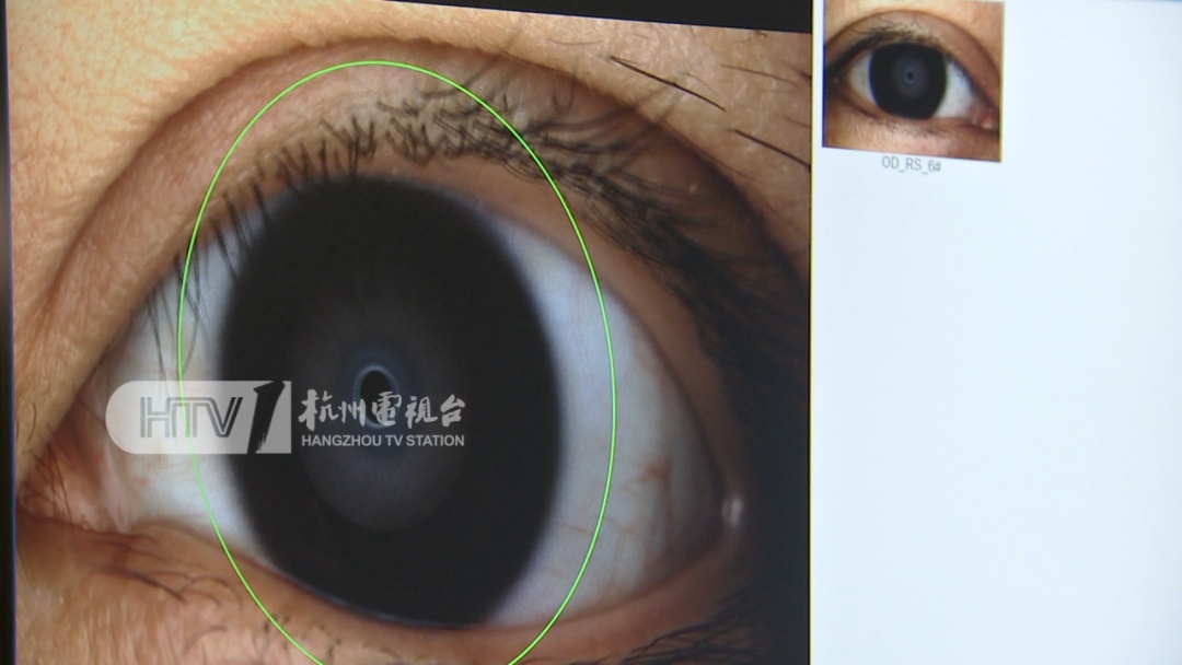 浙江一医院迎来就诊高峰,这种病女性更容易得!严重可能失明...... 浙江一医院迎来就诊高峰,这种病女性更容易得!严重可能失明......