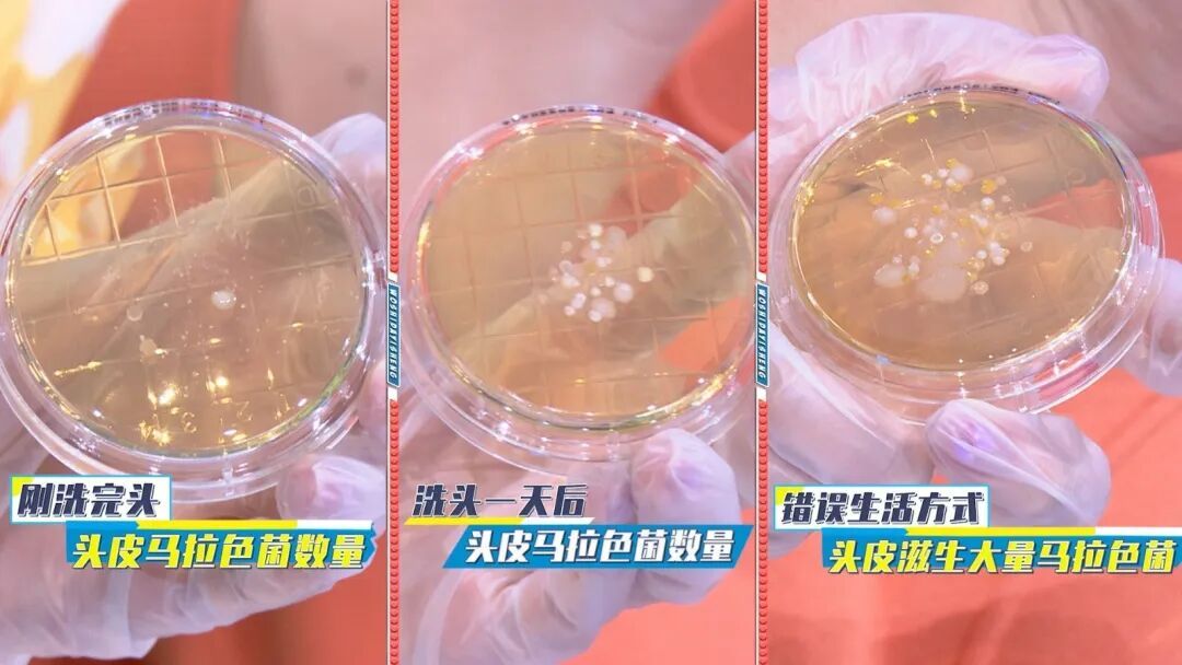 戴帽子或造成脱发?注意这几点 戴帽子或造成脱发?注意这几点