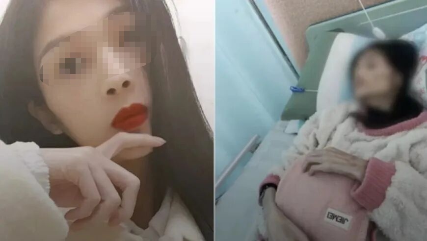 广东27岁女孩患胃萎缩后去世，体重曾从90多斤暴瘦至35斤
