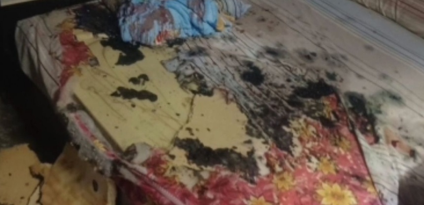 泰国一男子生日当天遭妻子泼酸袭击，全身多处灼伤