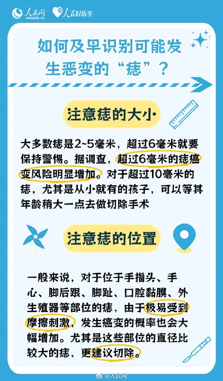 注意了！这些痣可能会发生癌变