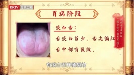 舌头是胃部 “直播屏”，40岁以上必看