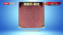 舌头是胃部 “直播屏”，40岁以上必看