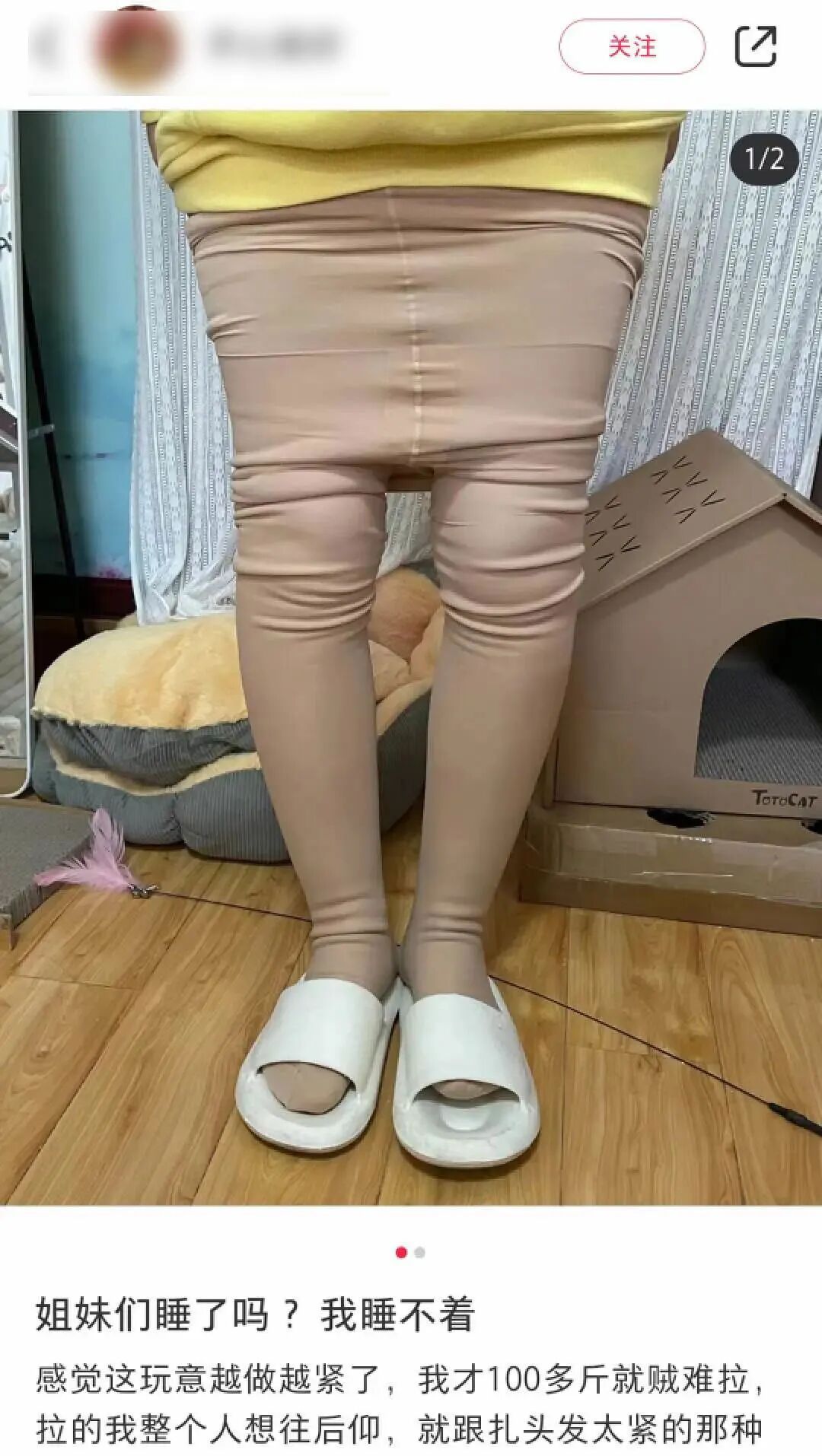 女孩穿“光腿神器”进了急诊：胸闷、呼吸困难，腿发麻……医生紧急提醒→