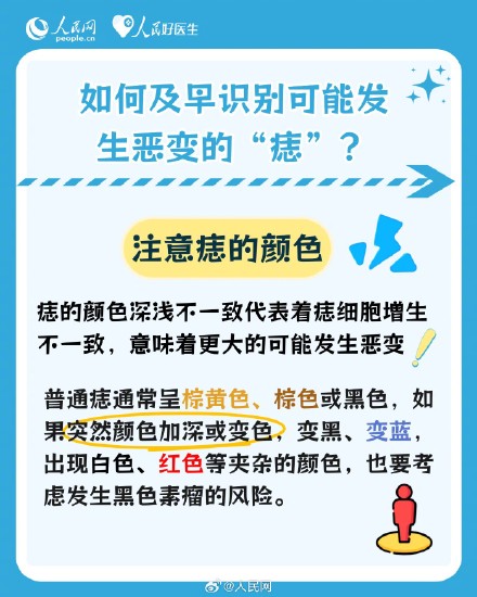 注意了！这些痣可能会发生癌变