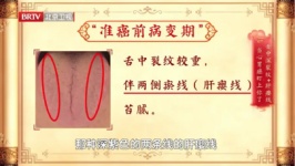 舌头是胃部 “直播屏”，40岁以上必看