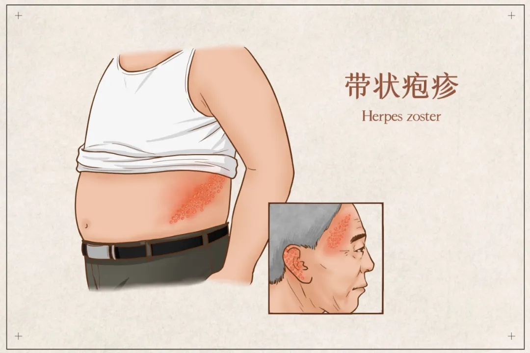 每年冬天杭州都有不少人中招，剧痛难忍......尽早去正规医院！