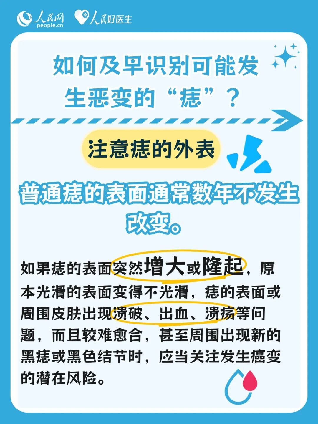 身上有痣的人注意了！这些痣可能会发生癌变→
