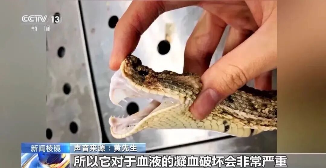 男子养五步蛇当宠物，喂食时被咬致大拇指截肢……专家提醒→