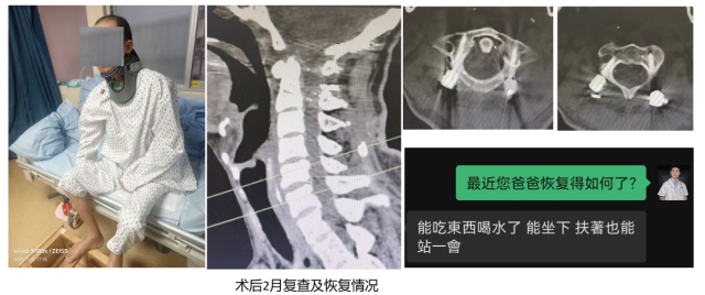 惊心动魄!60岁老人因意外“头颈分离”直送ICU 惊心动魄!60岁老人因意外“头颈分离”直送ICU
