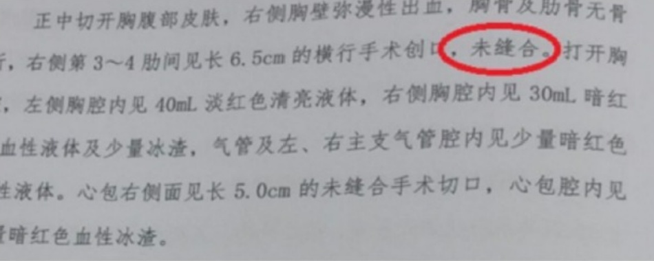 韩红怒了,为小洛熙发声 韩红怒了,为小洛熙发声