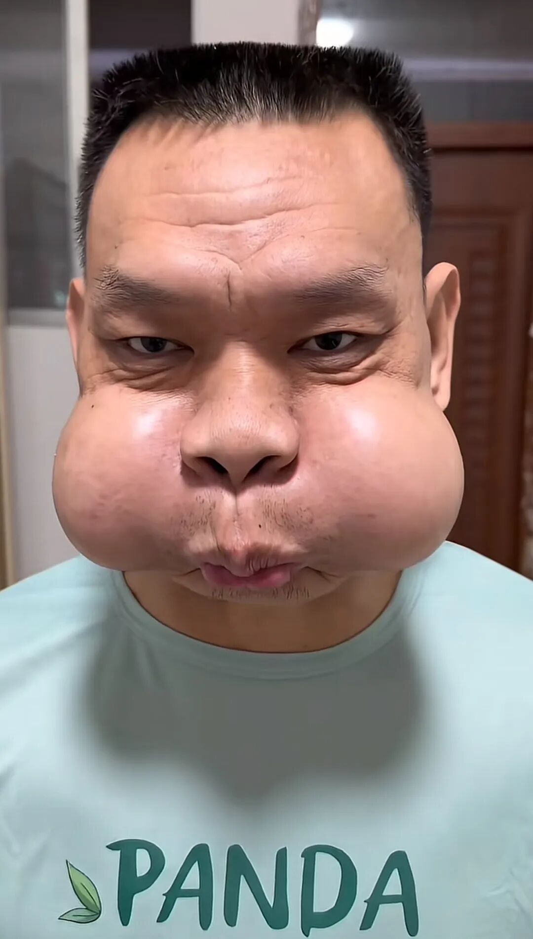 工作太不容易，男子面部严重变形！自嘲“青蛙王子”...这些都是职业病