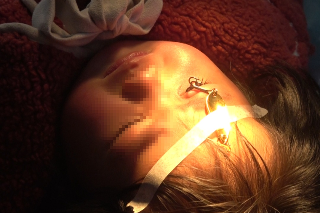 “偷袭”成功！它深深刺入左眼球，将男子送进医院