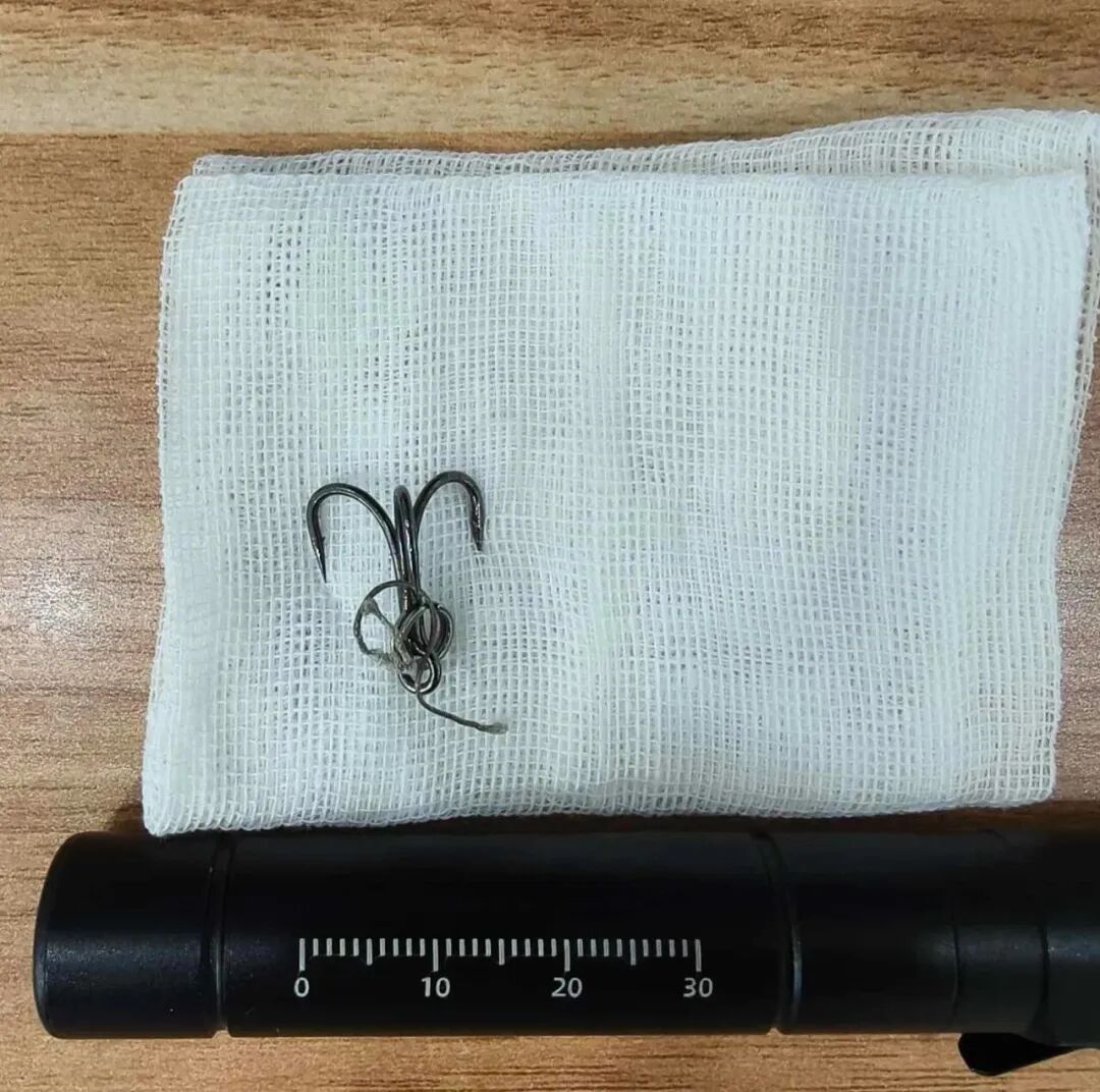 “偷袭”成功！它深深刺入左眼球，将男子送进医院