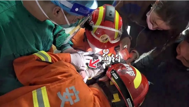 “偷袭”成功！它深深刺入左眼球，将男子送进医院