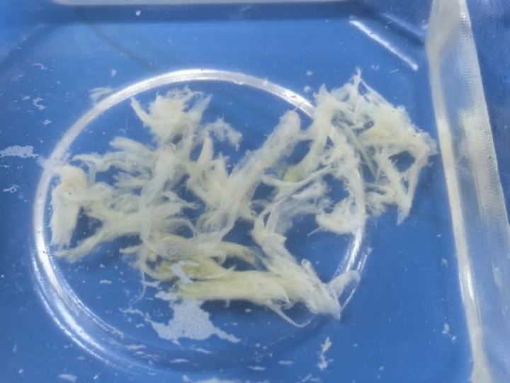 男孩上午刚发烧晚上肺就变白，在ICU里躺了10天！这4个重症前兆要当心