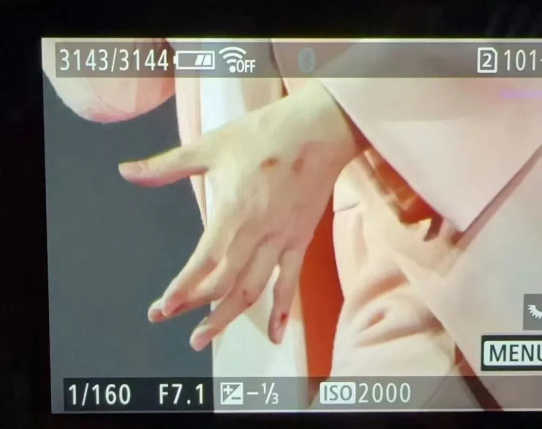 F4演唱会，他不慎踩空坠落！吴建豪飞奔查看