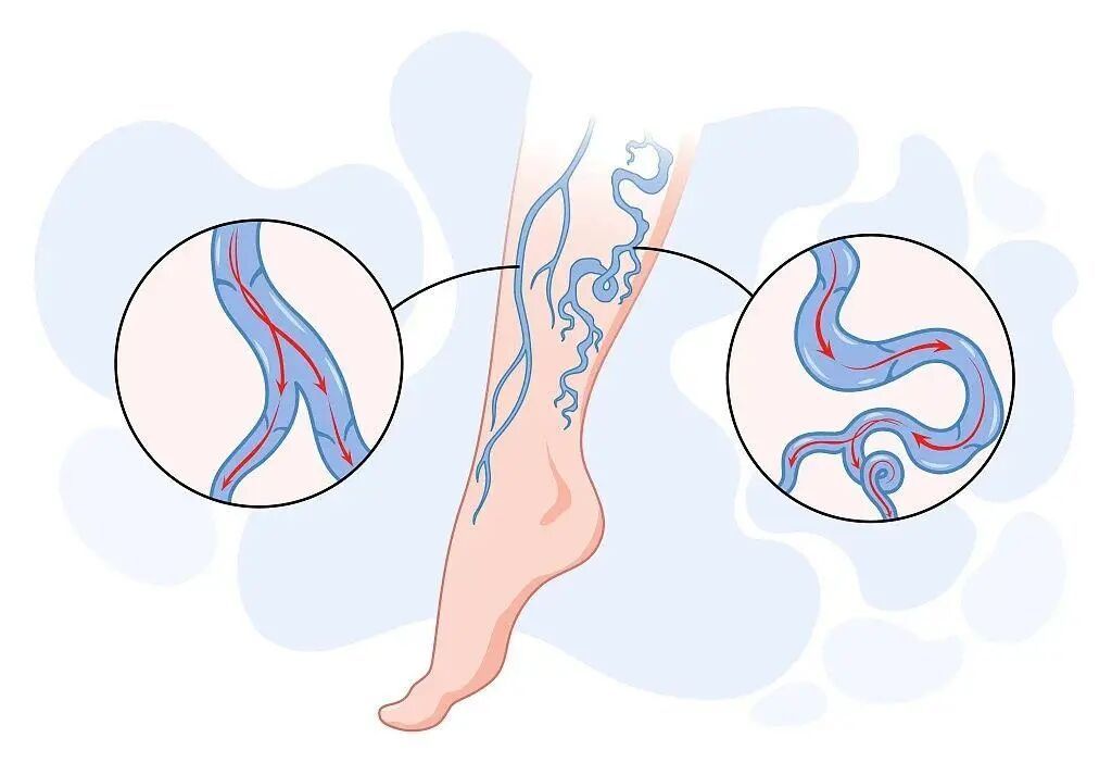 警惕：血管不好，从脸上能看出来！