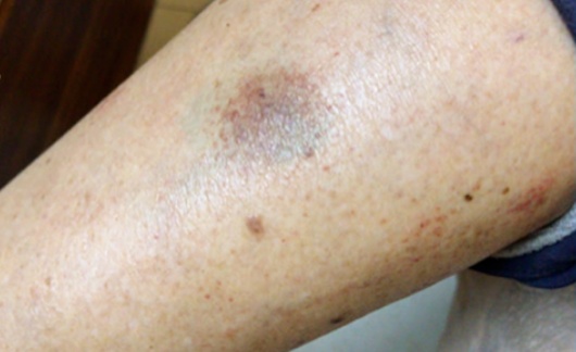 它是被忽视的骨骼"守护者"，就藏在你家餐桌里