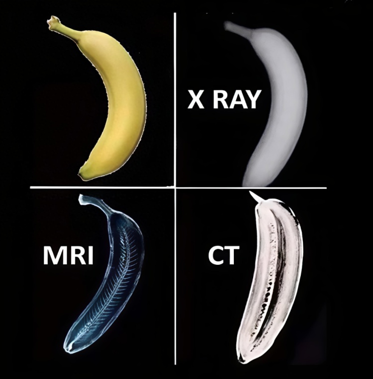 做CT容易致癌？一年最多拍几次？医生解答