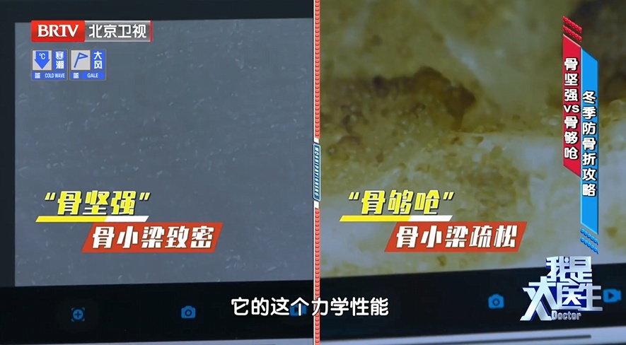 它是被忽视的骨骼"守护者"，就藏在你家餐桌里