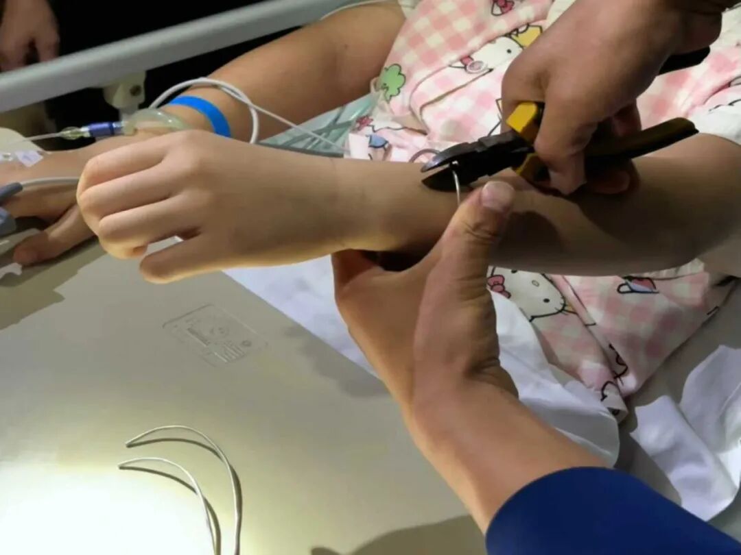 嵌入皮肉！女子的四镯一戒“逼停”救治