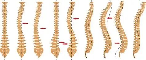 襄阳王女士（56岁），睡出骨折！这种常见行为，很多人每天都做