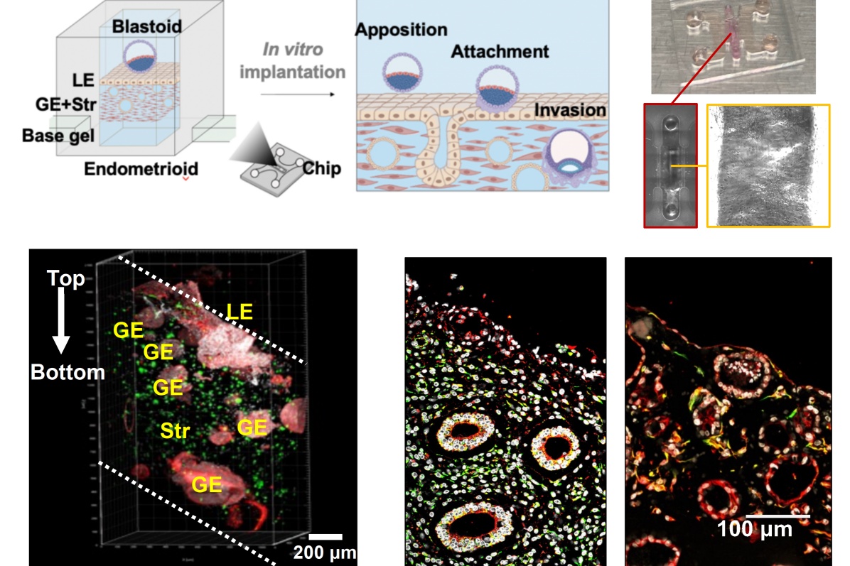 科研新突破！这项技术有望探明胚胎移植失败原因
