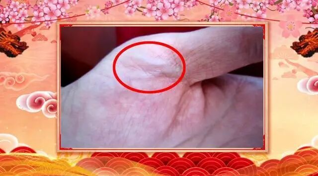 手上出现这些症状，是疾病来袭