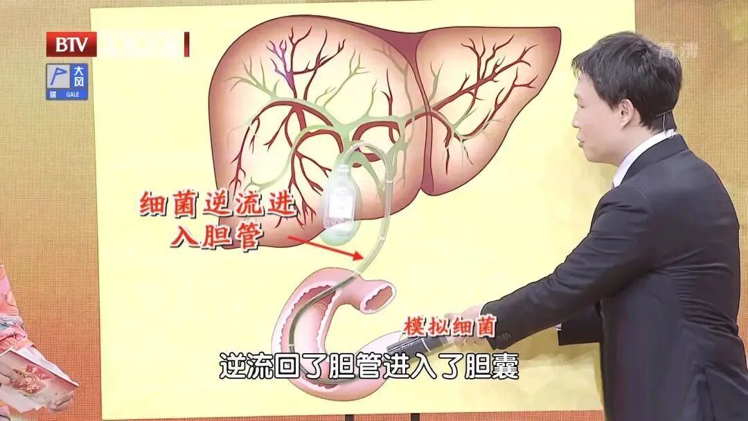 它是被忽视的骨骼"守护者"，就藏在你家餐桌里