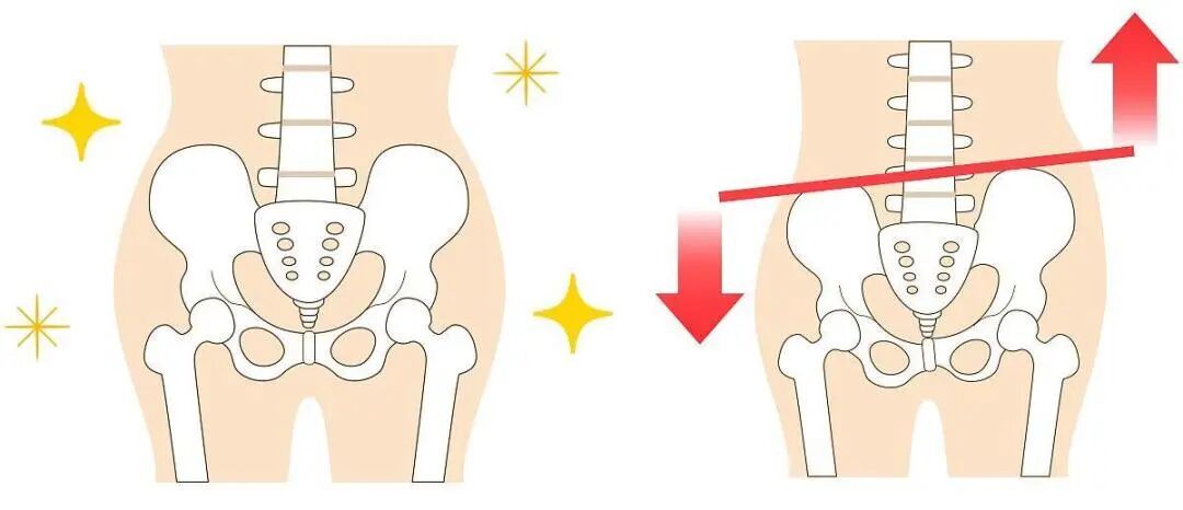 一“歪”毁所有，你中招了吗？自测方法+修复指南→