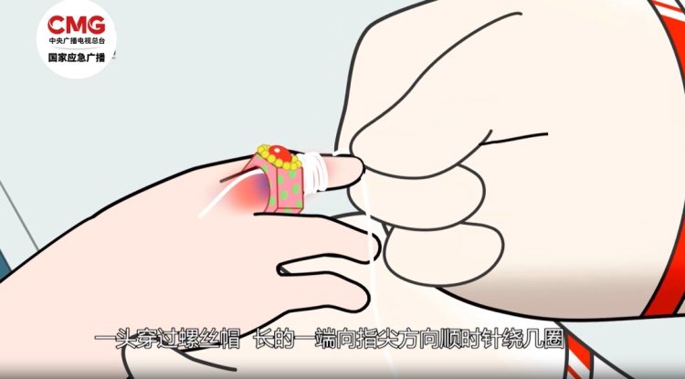 厨房这个地方利如刀片，手不要伸进去！