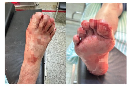 突然炸了！9岁女孩在卫生间痛哭！近期需格外注意