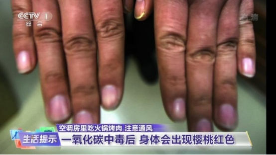 当前高发期！这个行为可致命，已有人洗澡时中毒