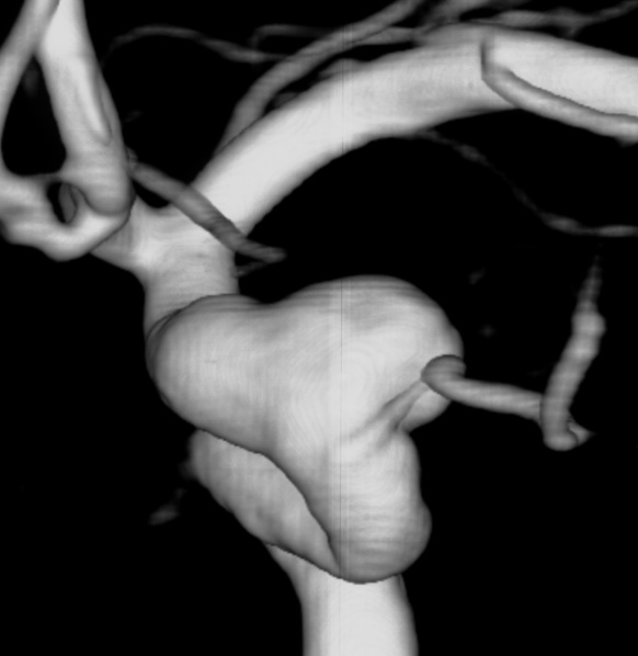 不是所有头痛都能忍，冬季这类疼痛要特别当心！